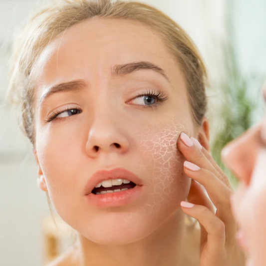 Skin Dryness, Dullness & Brightening