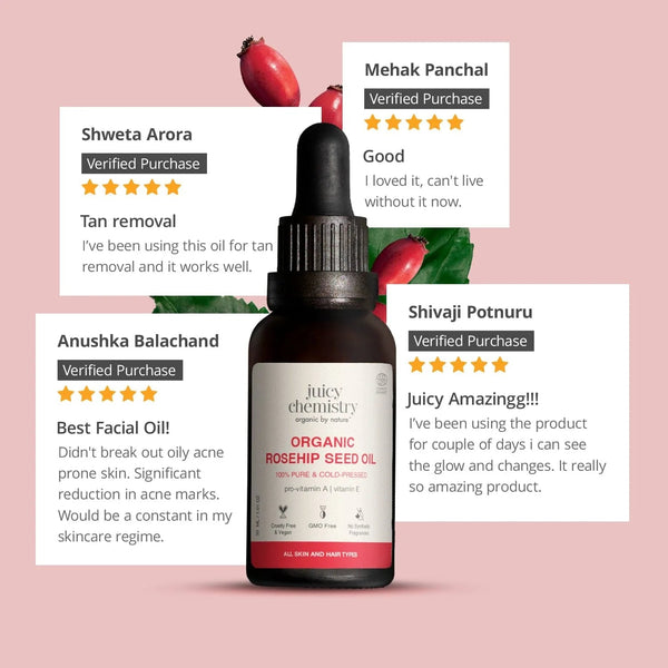 Juicy Chemistry Organic Rosehip Seed Oil bottle with rosehip berries, surrounded by five-star customer reviews praising tan removal, acne mark reduction, and skin glow