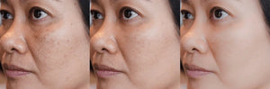 Clean Up Face Mask | Hydration Boost |Detoxifying | Pigmentation Care