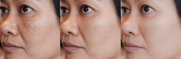 Clean Up Face Mask | Hydration Boost |Detoxifying | Pigmentation Care
